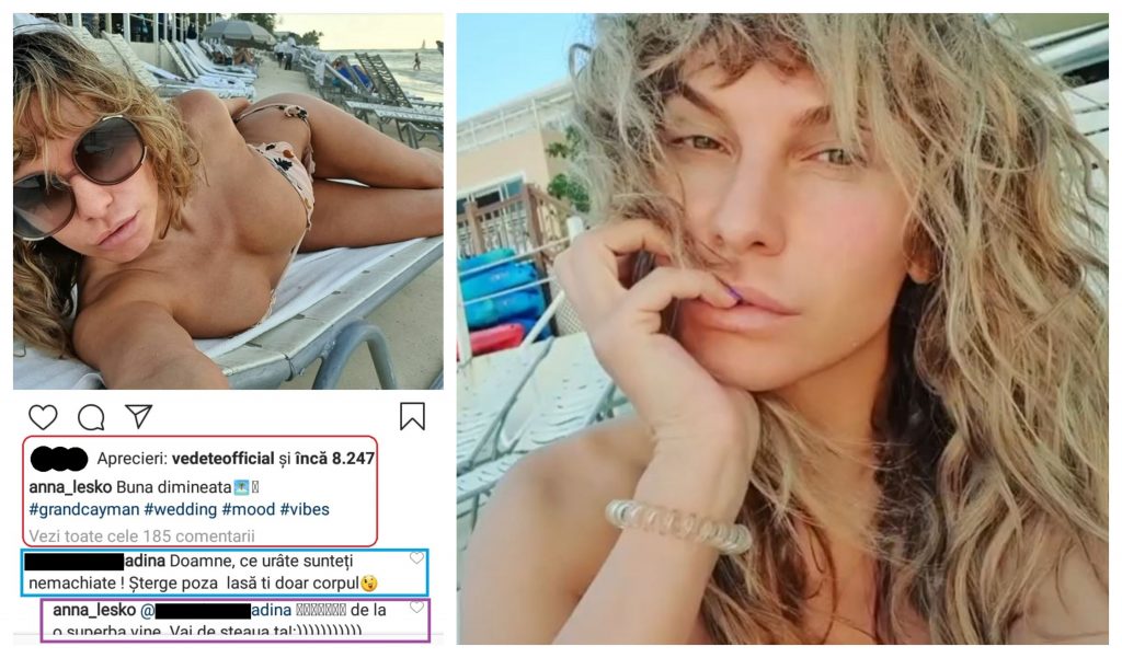 Anna Lesko a fost criticată dur după ce și-a pus poza din stânga colajului și a răspuns într-un mod neașteptat © Instagram