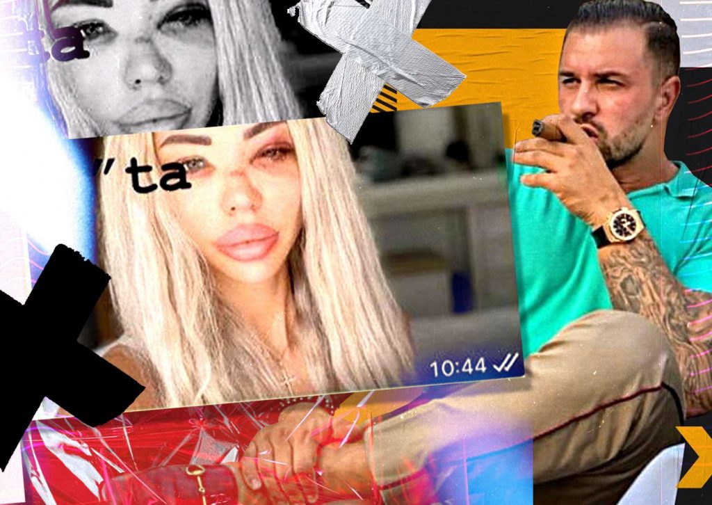 Imagine Stire Bianca Drăgușanu, desfigurată de Alex Bodi! Imaginea care îngrozește pe oricine… ”Să vedem ce spun autoritățile despre bărbăția ta!” + Prima reacție a agresorului: ”Ai cerut bani, iar eu te-am plătit!” | 2review.ro