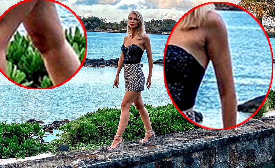 Imagine Stire Andreea Bălan a fost bătută?! A apărut cu vânătăi suspecte pe corp | 2review.ro