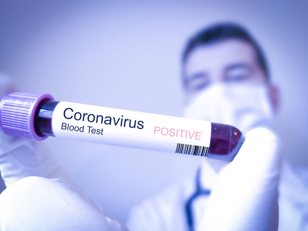 Imagine Stire Măsuri stricte la Ministerul Sănătății, ca urmare a infectării unei angajate cu noul coronavirus. Femeia revenise din Dubai | 2review.ro