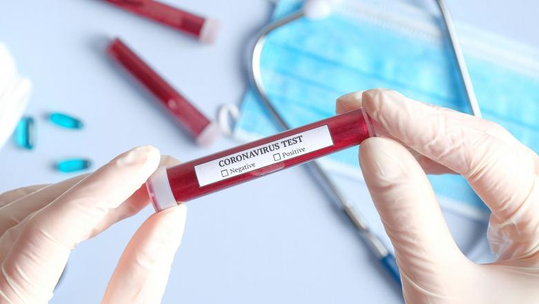 Imagine Stire Peste 2500 de teste pentru despistarea coronavirusului au fost confiscate la vamă, după ce un bucureștean a dat anunț pe internet că le vinde | 2review.ro