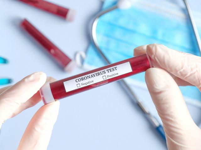 Imagine Stire Două surori românce au murit de coronavirus | 2review.ro
