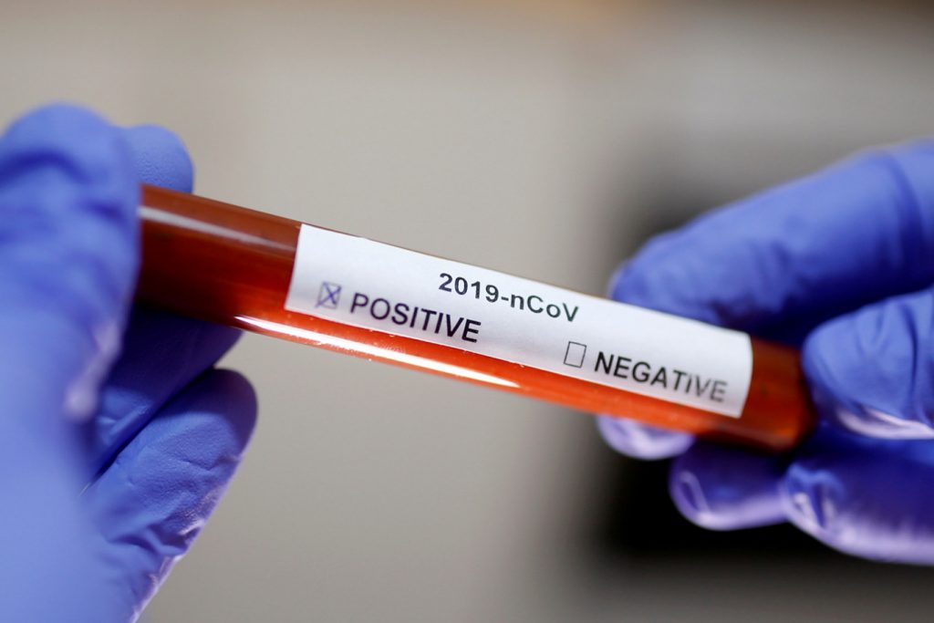 Imagine Stire Cel mai tânăr mort de coronavirus în România. Câți ani avea cazul nr 40 | 2review.ro