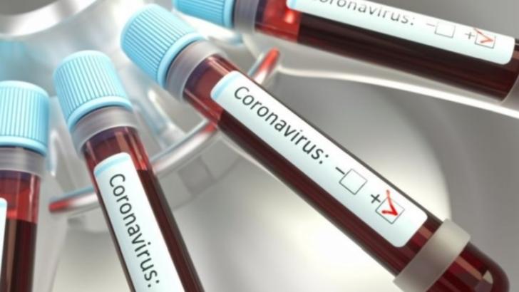Imagine Stire Primul test on-line care îți arată dacă ai fost infectat cu COVID-19 a fost lansat! Află dacă este momentul să ajungi la doctor | 2review.ro