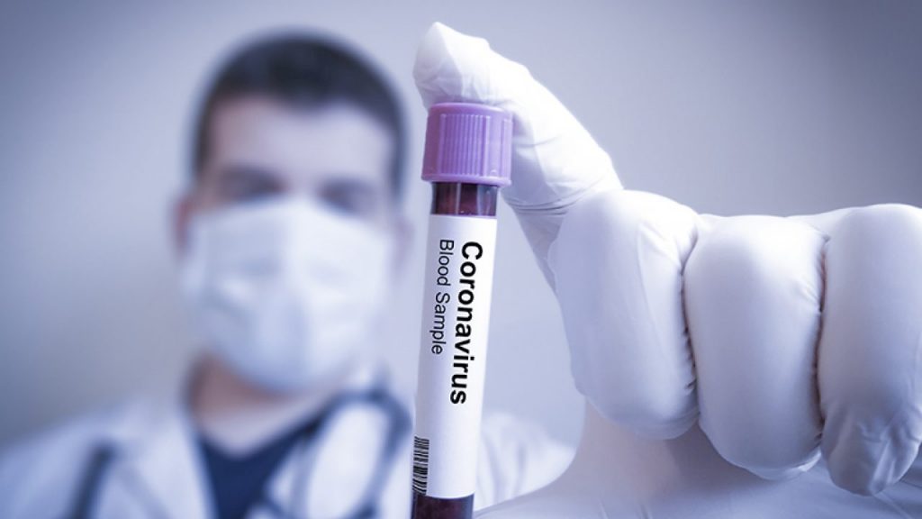 Imagine Stire Anunţul trist al unui medic de la Matei Balş! Când va fi vârful epidemiei de coronavirus, în România: „Între 10.000 şi 20.000 de cazuri” | 2review.ro