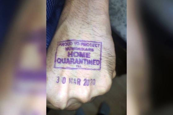 Imagine Stire Suspecții de coronavirus, ștampilați pe mâini! Dacă ai fugit din carantină, ești arestat. În ce țară se întâmplă așa ceva | 2review.ro