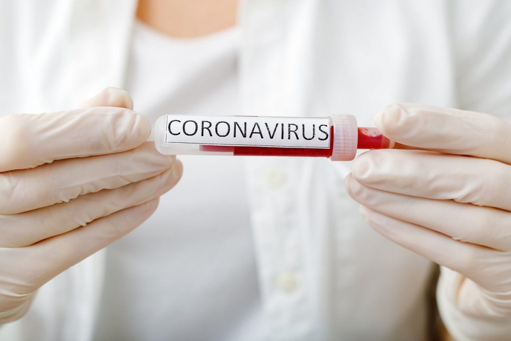 Imagine Stire Criza coronavirusului. Modelul declarației cu care cetățenii din România pot ieși din casă în intervalul 22.00 – 06.00 | 2review.ro