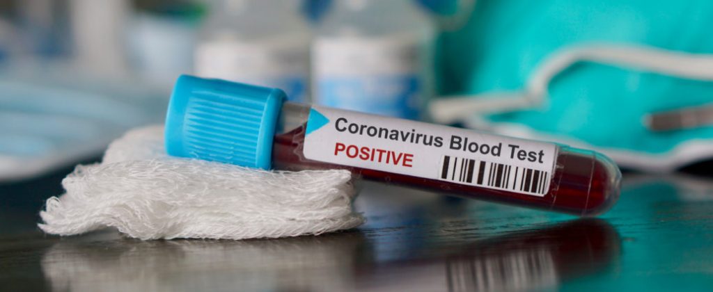 Imagine Stire Coronavirus România. Numărul deceselor din cauza COVID-19 a ajuns la 469 | 2review.ro