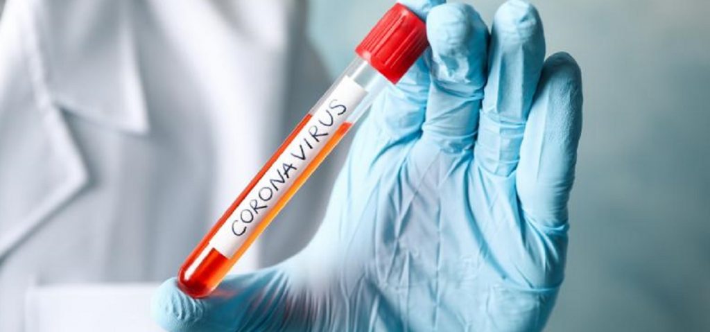 Imagine Stire Coronavirus. Harta lumii, din ce în ce mai roșie! Pe ce loc se situează România, în topul țărilor afectate de Covid-19 | 2review.ro