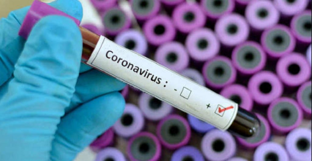 Imagine Stire COVID-19, raport săptămânal de supraveghere. Județele unde s-au înregistrat cele mai multe cazuri. Categoria vulnerabilă în cazul deceselor | 2review.ro