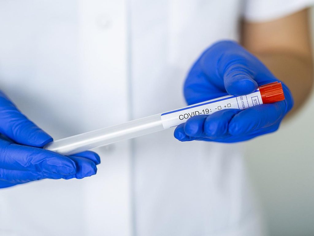 Imagine Stire Se schimbă tot ce ştiam despre coronavirus! Care sunt românii cu risc maxim de deces din cauza coronavirusului! Statistica oficială este îngrijorătoare | 2review.ro