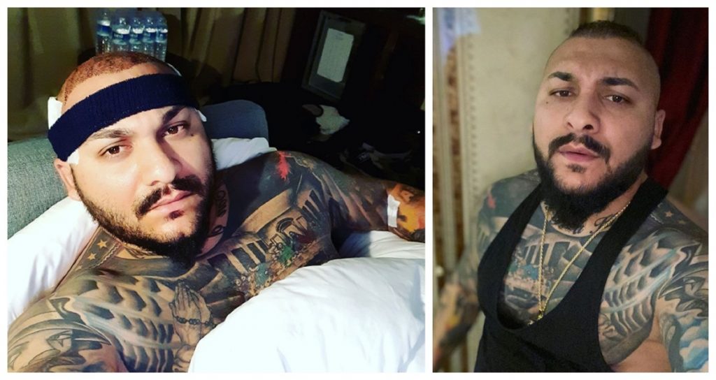 Imagine Stire Să vezi și să nu crezi! Cum arată Dani Mocanu, după implantul de păr: „Ai dat banii de pomană, zici că ești…” | 2review.ro