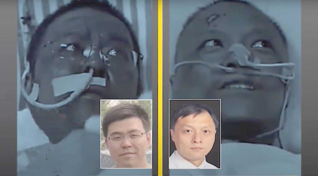 Imagine Stire Incredibil! Infectați cu noul coronavirus, doi medici chinezi s-au trezit cu pielea închisă la culoare! Explicațiile specialiștilor | 2review.ro