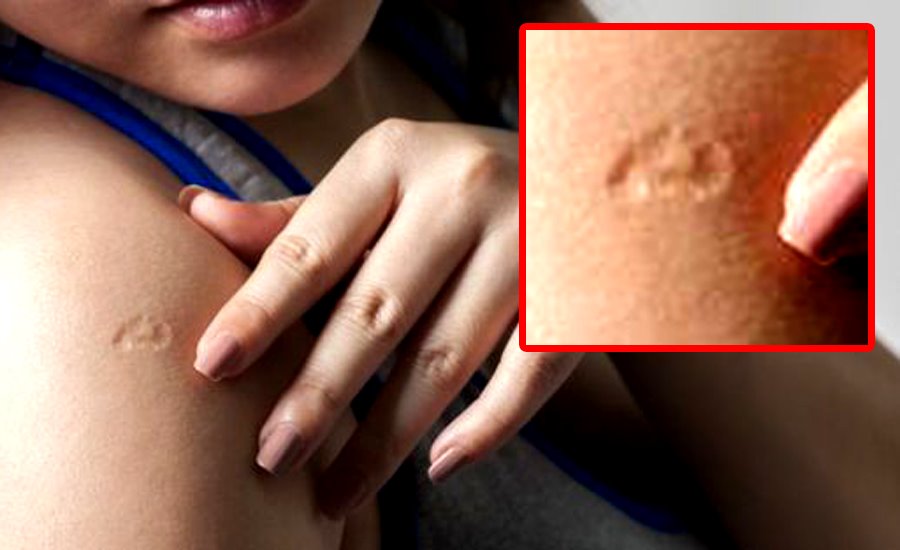 Imagine Stire Descoperire uluitoare pentru români! Ai și tu acest semn pe braț? Te-ar putea feri de coronavirus | 2review.ro