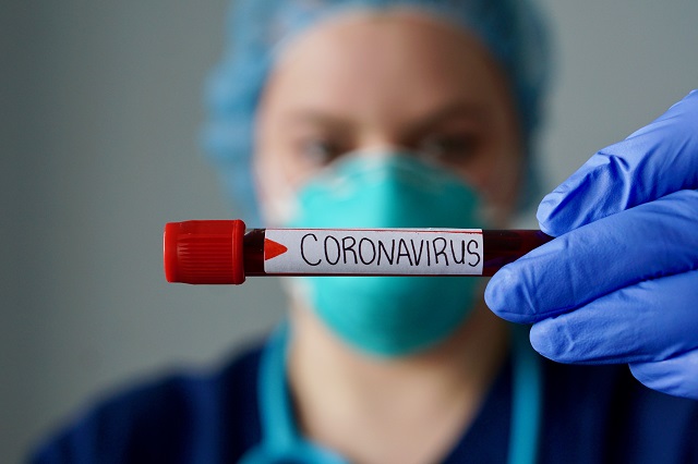 Cercetătorii au descoperit temperatura la care coronavirusul se răspândește cel mai repede