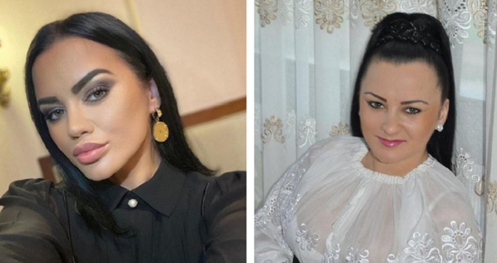 Imagine Stire Care este prima intervenție estetică la care a apelat Carmen de la Sălciua. Nimeni nu a știut până acum! | 2review.ro
