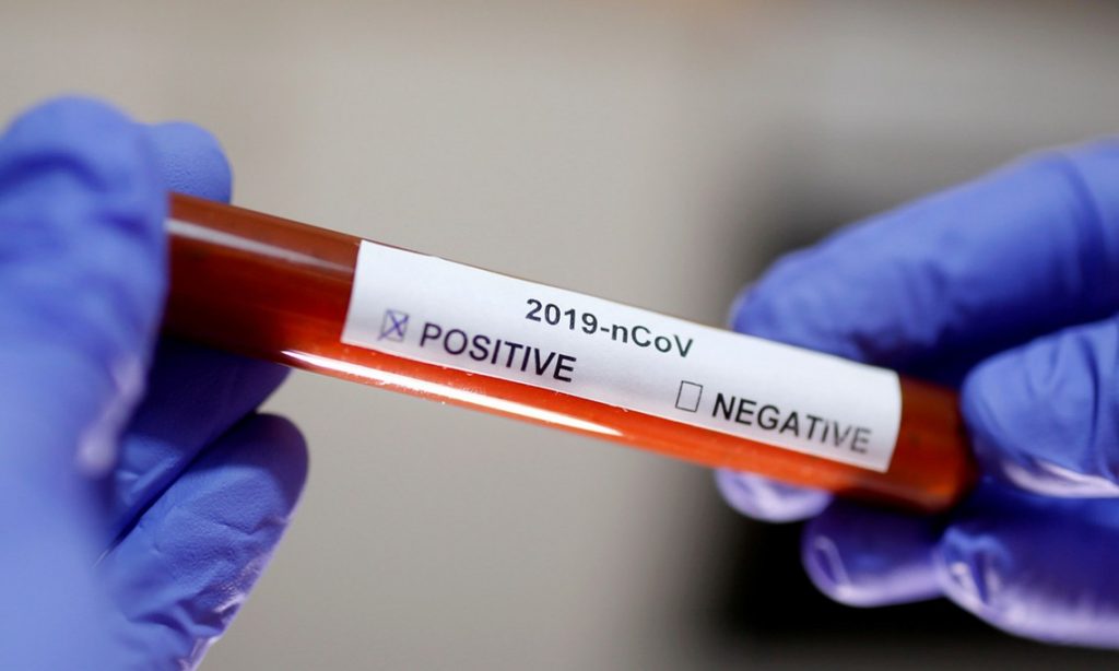 Imagine Stire Numărul deceselor cauzate de coronavirus în SUA a crescut din nou! | 2review.ro