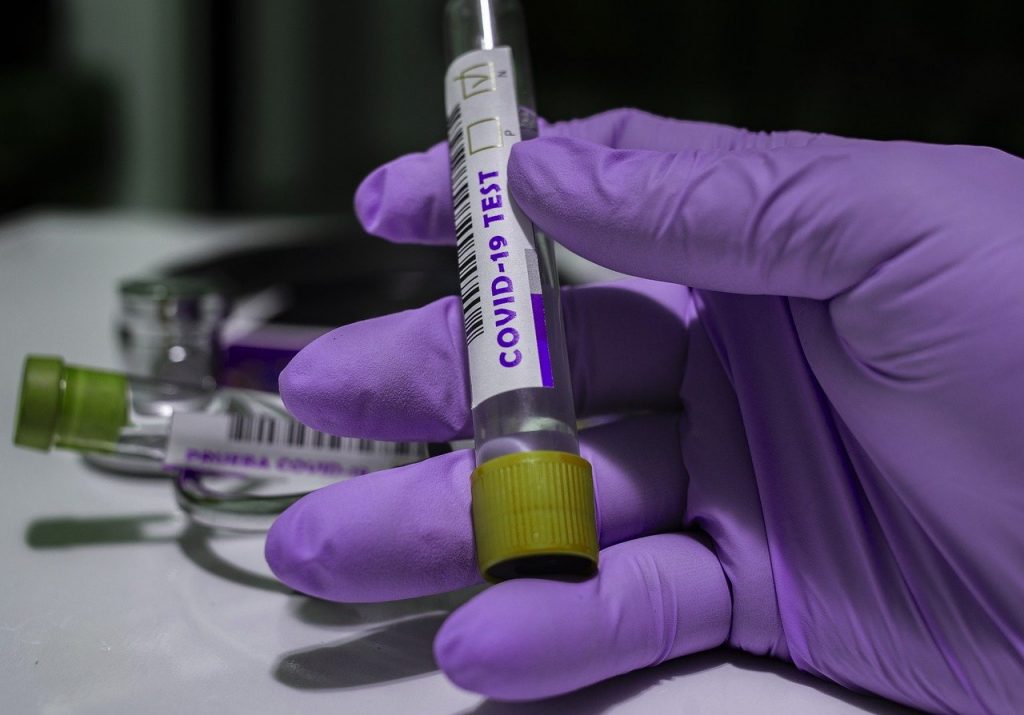 Imagine Stire Gafă amuzantă a Grupului de Comunicare Strategică. Un bărbat din Sibiu, confirmat pozitiv cu noul coronavirus pe o dată inexistentă | 2review.ro