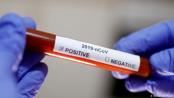 Imagine Stire Coronavirus în România. Patru oameni au decedat. Numărul total – 1343 | 2review.ro