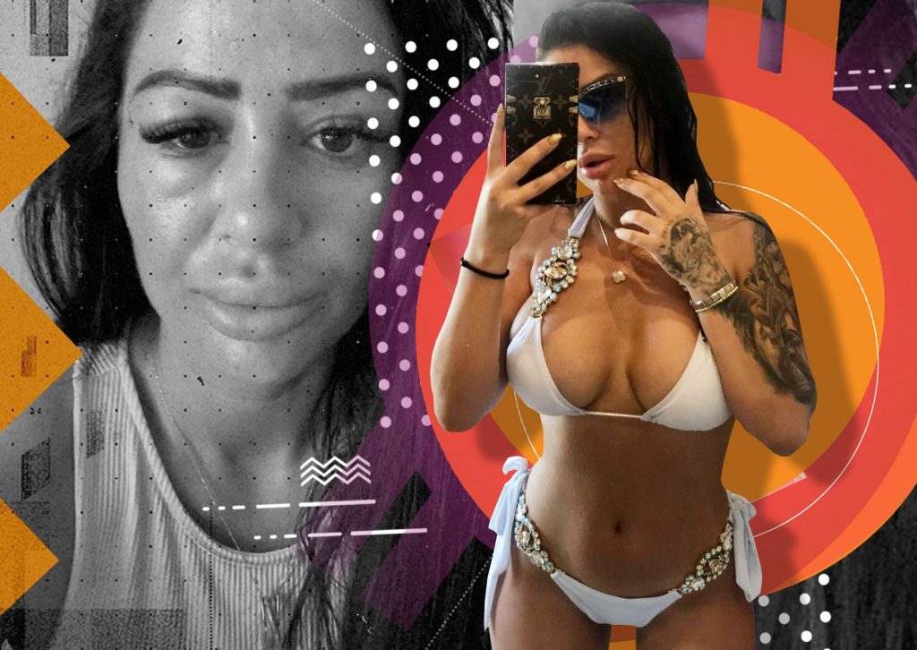 Imagine Stire O bombă-sexy acuză medicul estetician că i-a greșit intervenția: “Am apăsat într-o seară pe ochi și mi-a ieșit un…” | 2review.ro