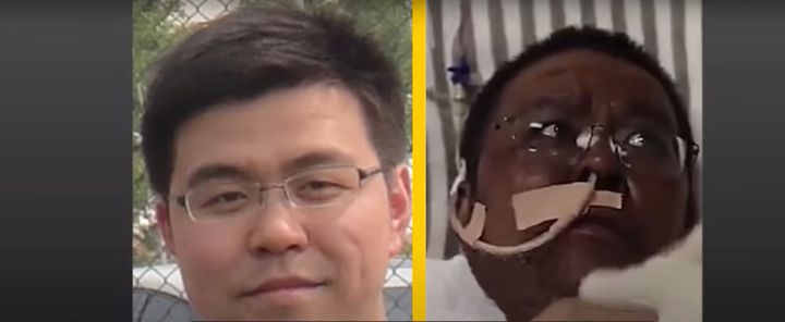 Imagine Stire Infectat cu coronavirus, Hu Weifeng s-a stins din viață! Recent, s-a trezit cu pielea închisă la culoare și… | 2review.ro