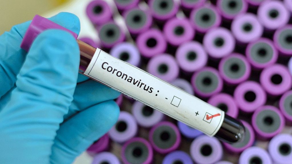 Imagine Stire Alertă! Numărul pacienților infectați cu coronavirus de la Spitalul Victor Babeș s-a dublat. “Sunt aduși de DSP!” | 2review.ro