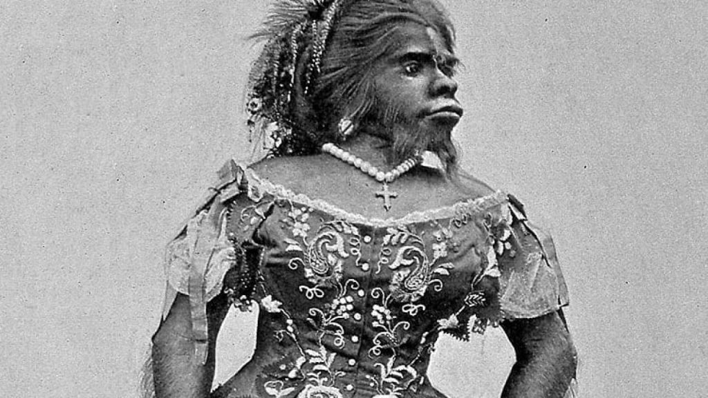 Imagine Stire Cine era Julia Pastrana? Anomalia genetică extrem de rară care o făcea pe această femeie să arate ca un…urangutan | 2review.ro