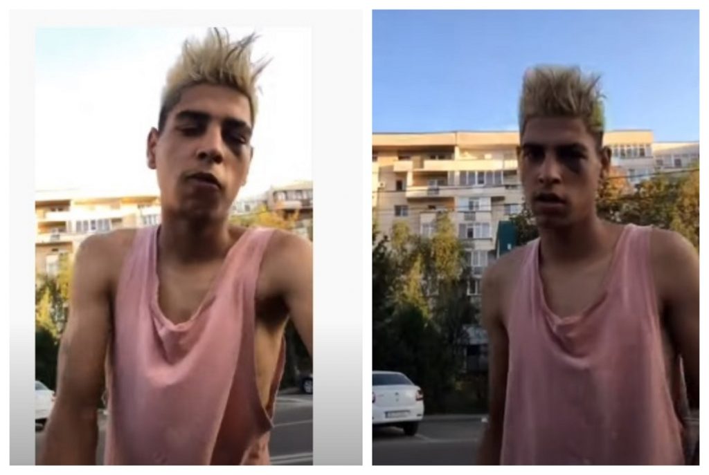Imagine Stire Ștefan de la Craiova, bătut măr și învinețit! Celebrul „Șeptar” vrea răzbunare: „Ștefan n-a murit”. VIDEO | 2review.ro