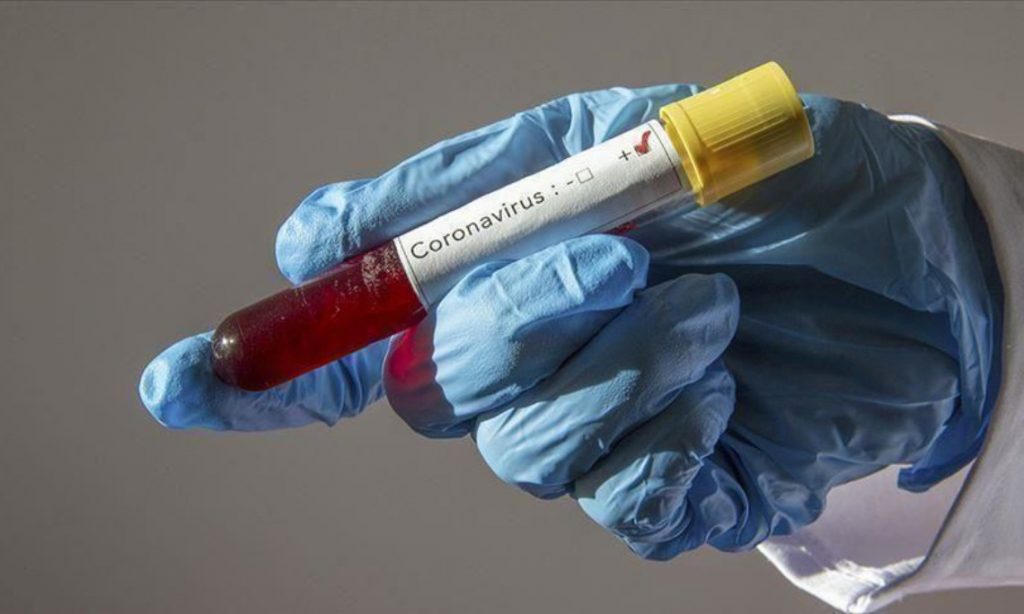Imagine Stire Coronavirus România 27 august. Record de infectări! Câți oameni au murit în ultimele 24 de ore | 2review.ro