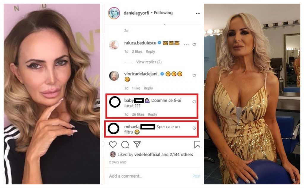 Daniela Gyrofi a fost aspru criticată din cauza operațiilor estetice după ce și-a pus recent pe Instagram fotografia din stânga colajului. Iar poza din dreapta colajului este făcută în septembrie 2018 © Instagram / Facebook