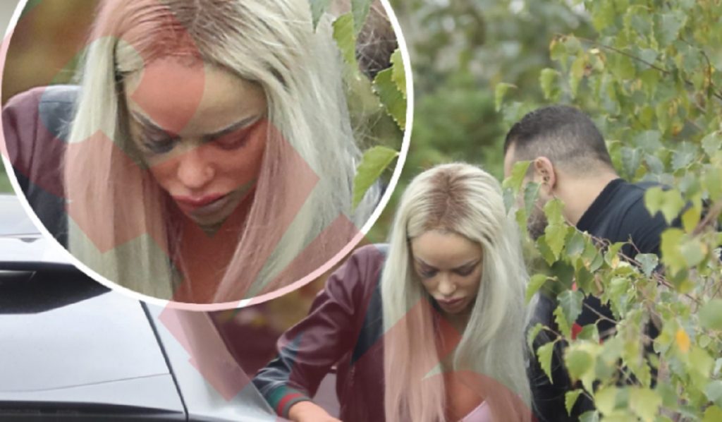 Imagine Stire Ce a făcut Bianca Drăgușanu, după ce Alex Bodi a desfigurat-o, din nou, în bătaie. FOTO | 2review.ro