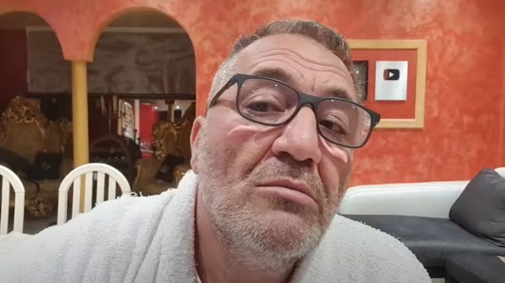 Imagine Stire Nelson Mondialu, bătut în scara blocului de mai mulți indivizi. Primele imagini cu urmele atacului: „Cinci au fost pe mine…” | 2review.ro