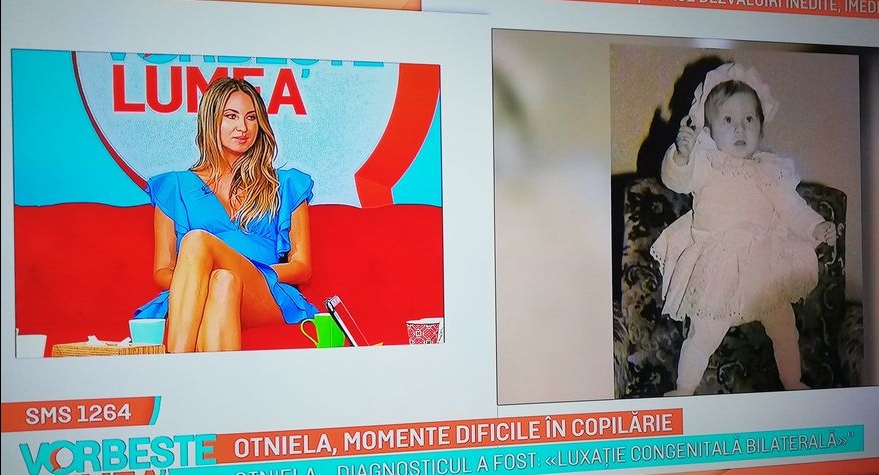 Imagine Stire Otniela, dezvăluiri tulburătoare: ”Am avut un picior mai scurt!” Când a făcut primii pași | 2review.ro