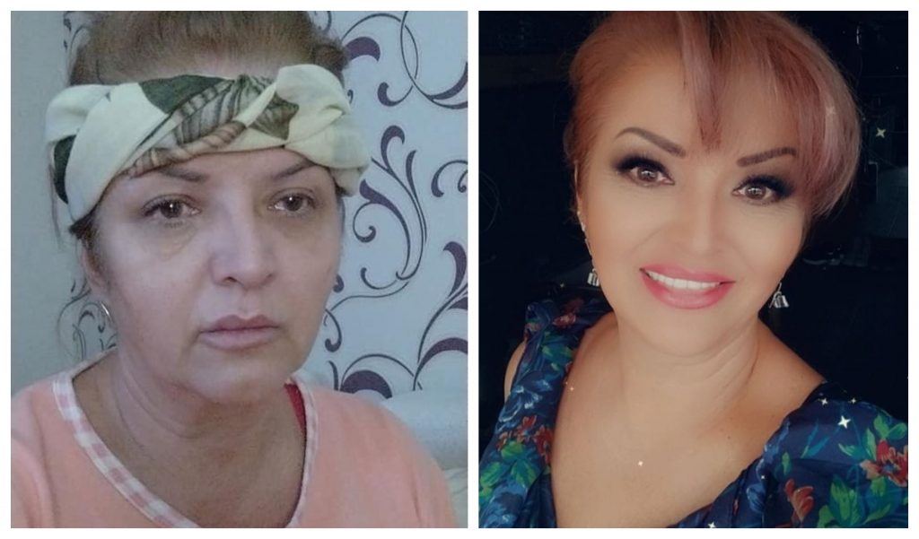Imagine Stire Carmen Rădulescu, probleme de sănătate! Artista refuză să se interneze în spital și se tratează acasă | 2review.ro