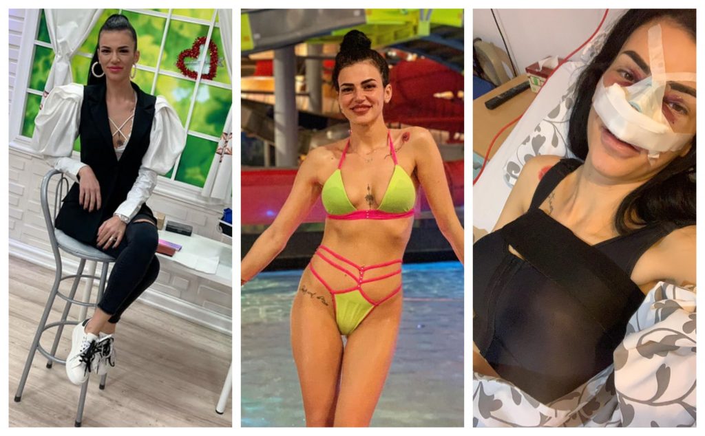 Prezentatoarea emisiunii “Folclorul sub lupă”, difuzată la Etno TV, și-a pus implanturi mamare cu silicon și și-a făcut rinoplastie © Facebook / starpopular.ro