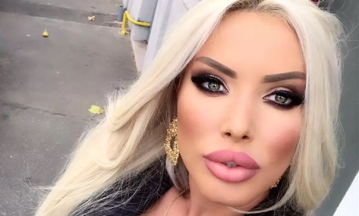 Loredana Chivu a ajuns din nou pe mâna medicului. La ce procedură a mai apelat blondina, pentru a demonstra că o ține buzunarul