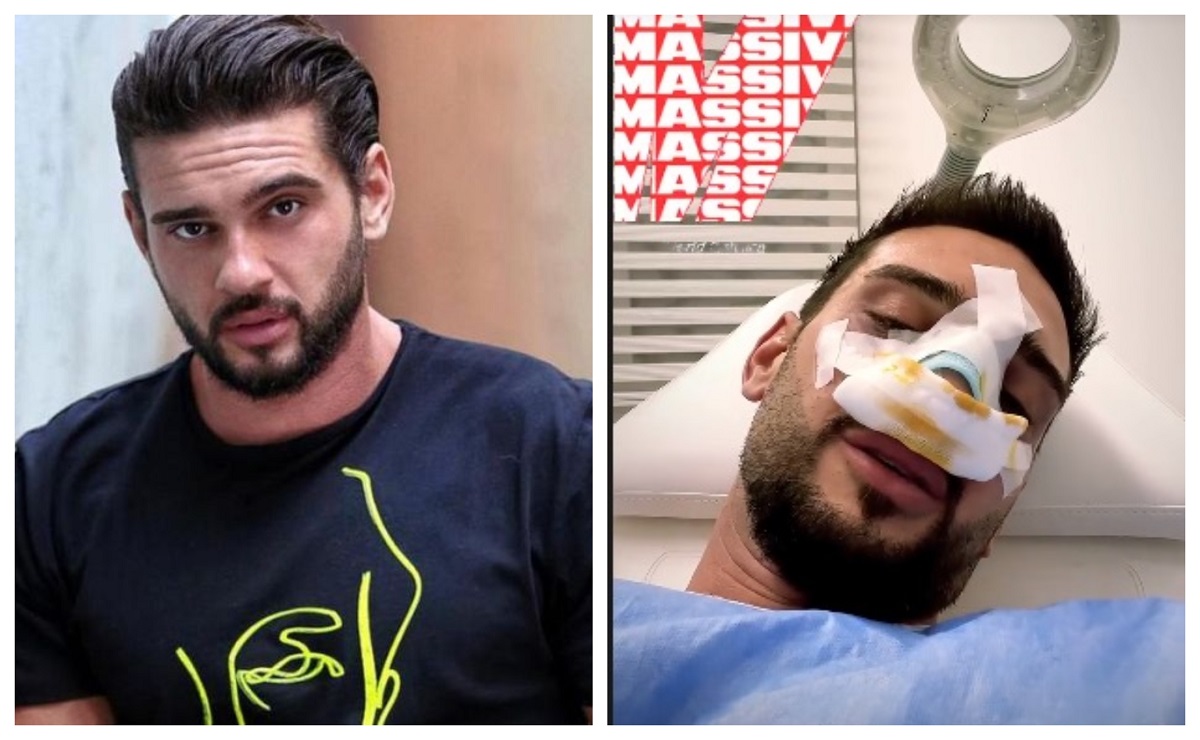 A zis că nu-și va opera nasul niciodată, dar s-a răzgândit! Cum arată Dorian „Hâtz” Popa, după ce și-a făcut rinoplastie