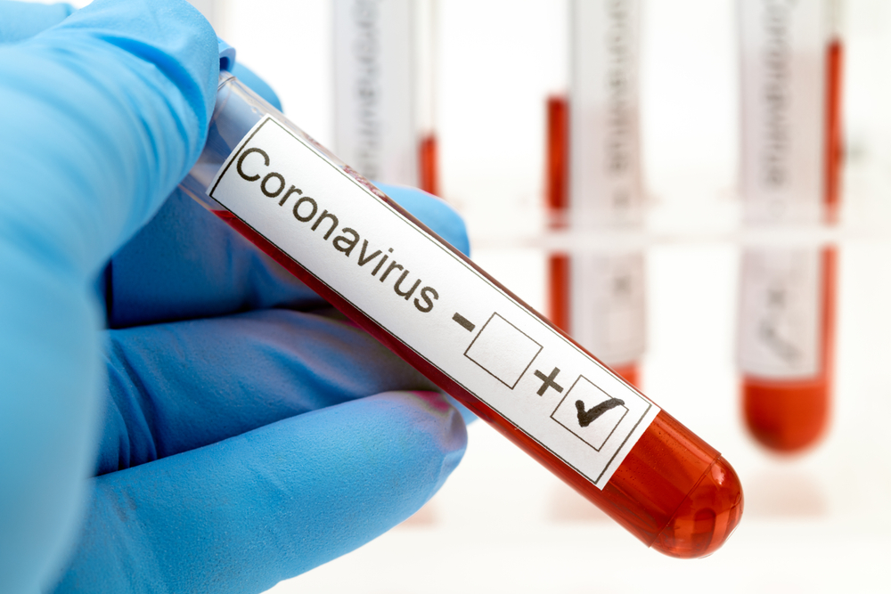 Coronavirus România, 20 februarie. Câte decese s-au înregistrat în ultimele 24 de ore