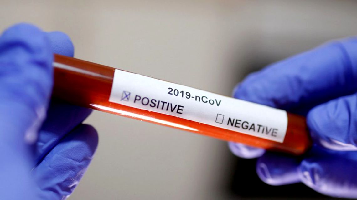 Coronavirus România 24 februarie. Câte persoane s-au infectat în ultimele 24 de ore