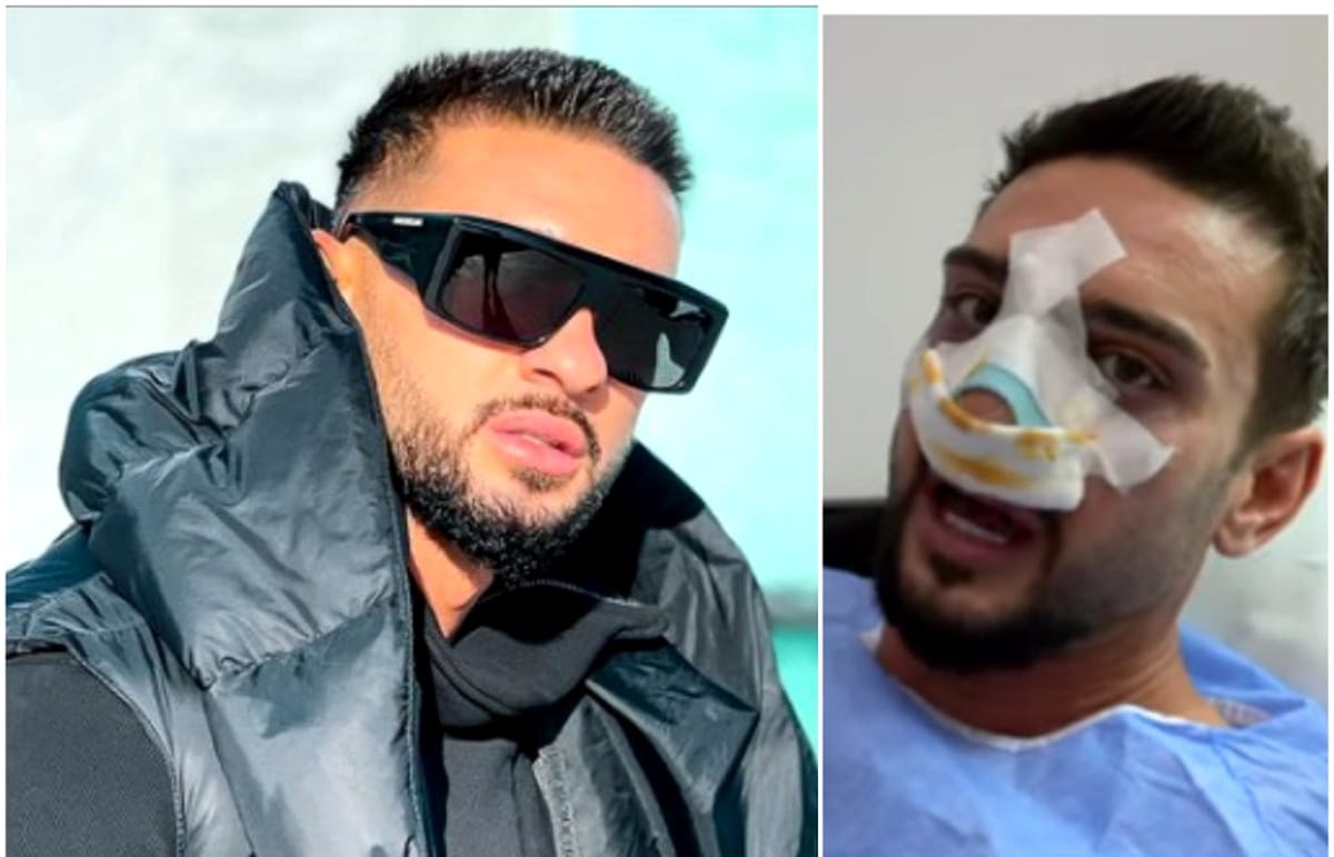 Motivul real pentru care Dorian Popa nu-și operează nasul. Care este cea mai mare frică a artistului