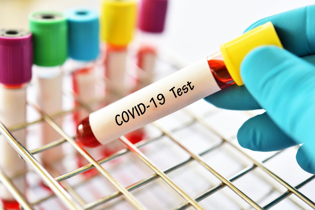 Imagine Stire Coronavirus România, 10 mai 2021. Câte cazuri noi SARS-CoV-2 s-au înregistrat, în ultimele 24 de ore | 2review.ro