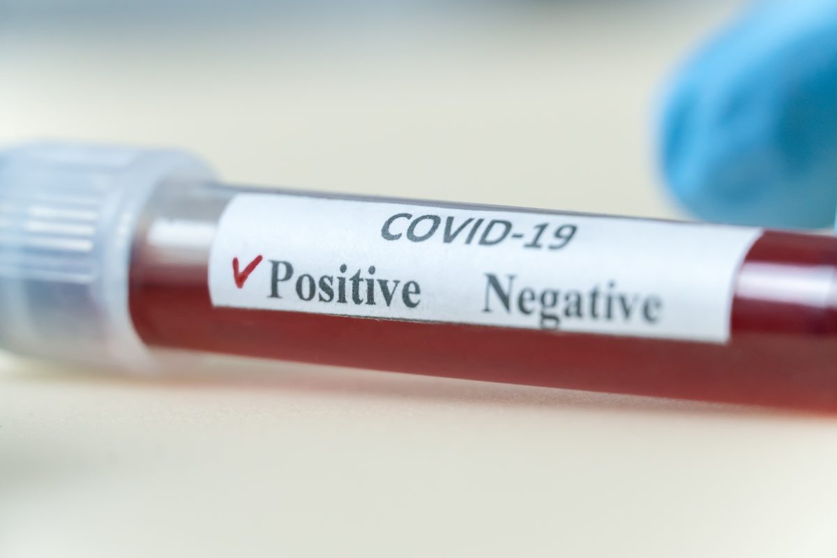 Coronavirus România, 3 mai 2021. Câte cazuri noi SARS-CoV-2 s-au înregistrat, în a doua zi de Paște