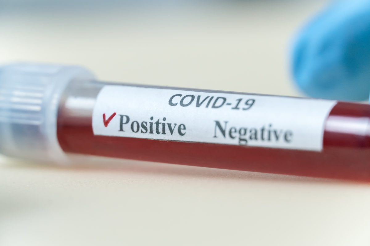 Imagine Stire Coronavirus România, 3 mai 2021. Câte cazuri noi SARS-CoV-2 s-au înregistrat, în a doua zi de Paște | 2review.ro