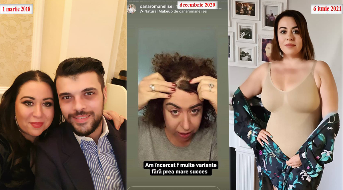 Podoaba capilară a Oanei Roman în diferite perioade © Facebook & Instagram