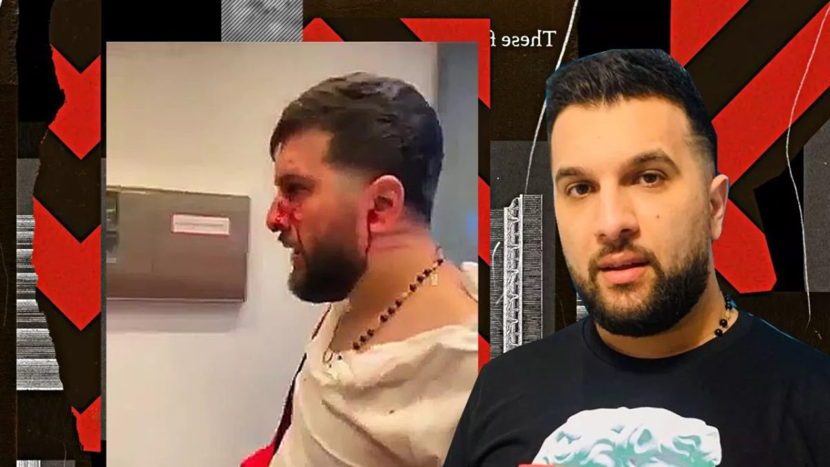 Imagine Stire Tzancă Uraganu a recunoscut că a fost bătut în Germania! Manelistul a povestit cine sunt, de fapt, agresorii lui | 2review.ro