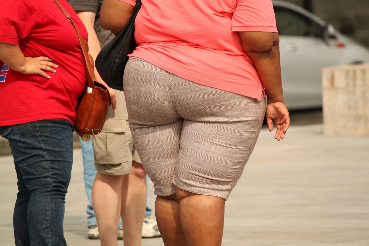 Premieră în Iași! Incredibil ce au descoperit medicii în burta unei femei care cântărește 220 de kg. Femeia avea dureri abdominale
