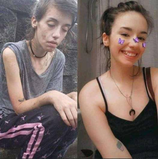 Chinurile prin care a trecut o tânără de 24 de ani. Cum arată acum, după ce a fost dependentă de droguri: ”Am o gaură în inimă”