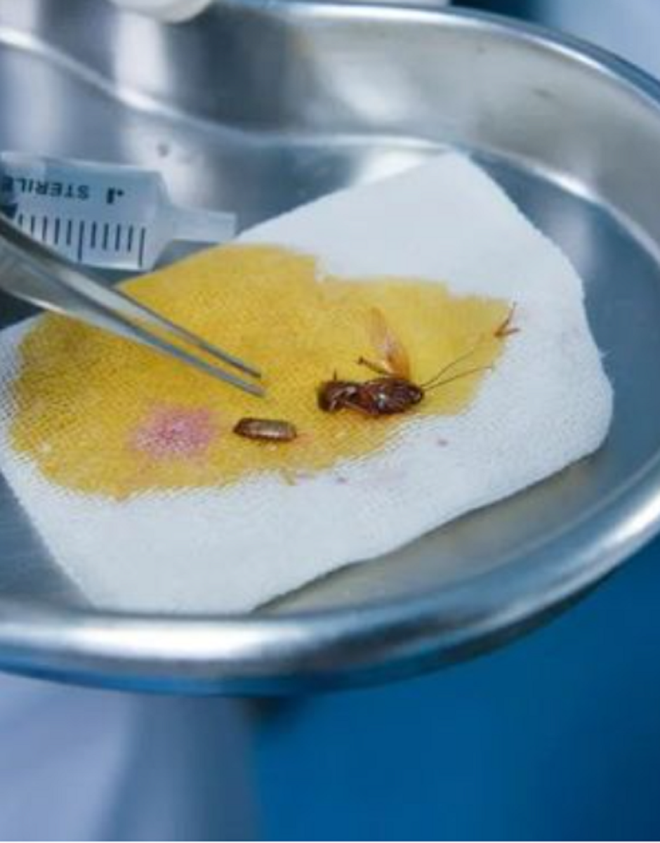 Descoperire terifiantă a medicilor! Ce au găsit în urechea unui tânăr care se plângea de dureri crunte