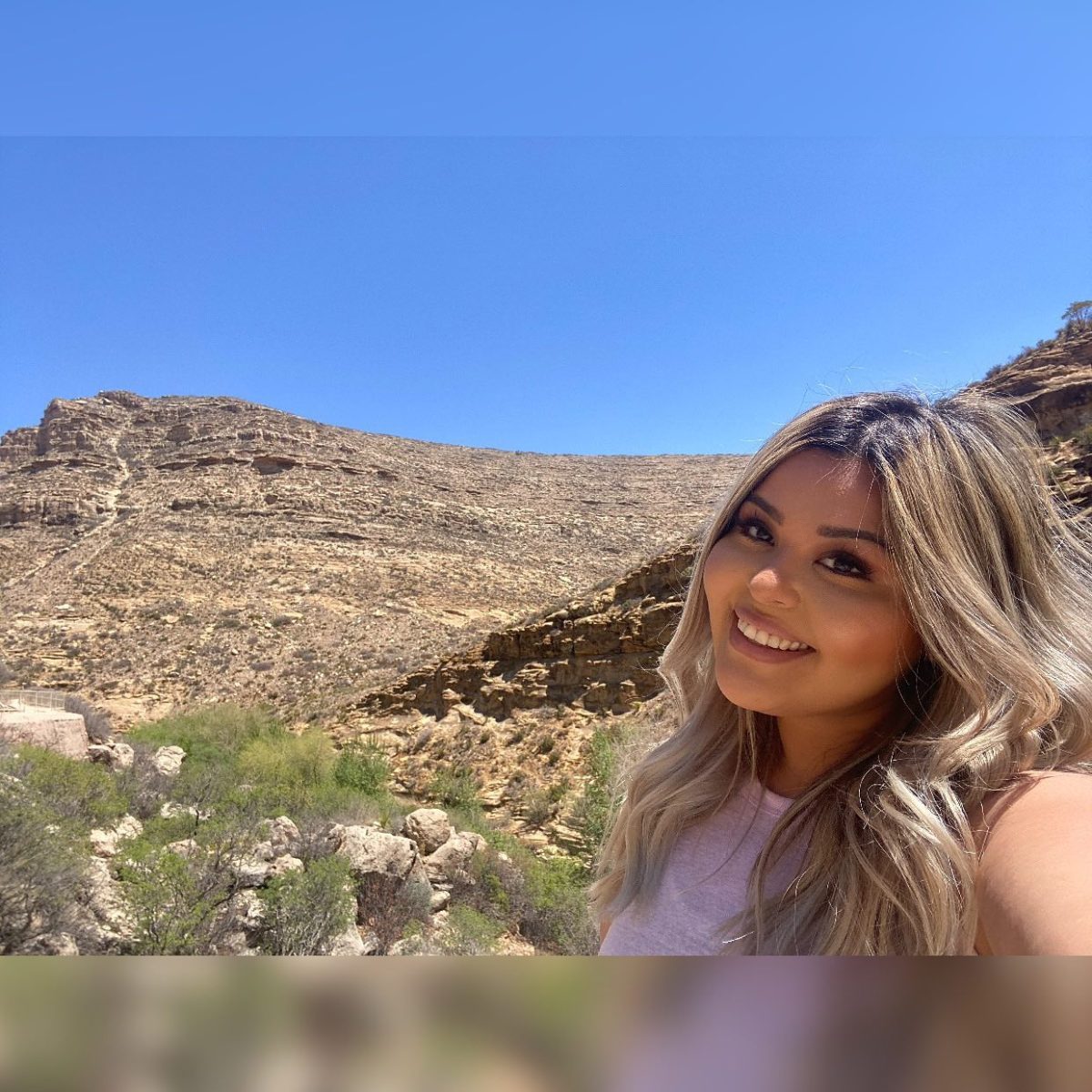 Povestea halucinantă a unei tinere din Texas. Medicii i-au descoperit o tumoră ovariană gigant, plină de păr și dinți