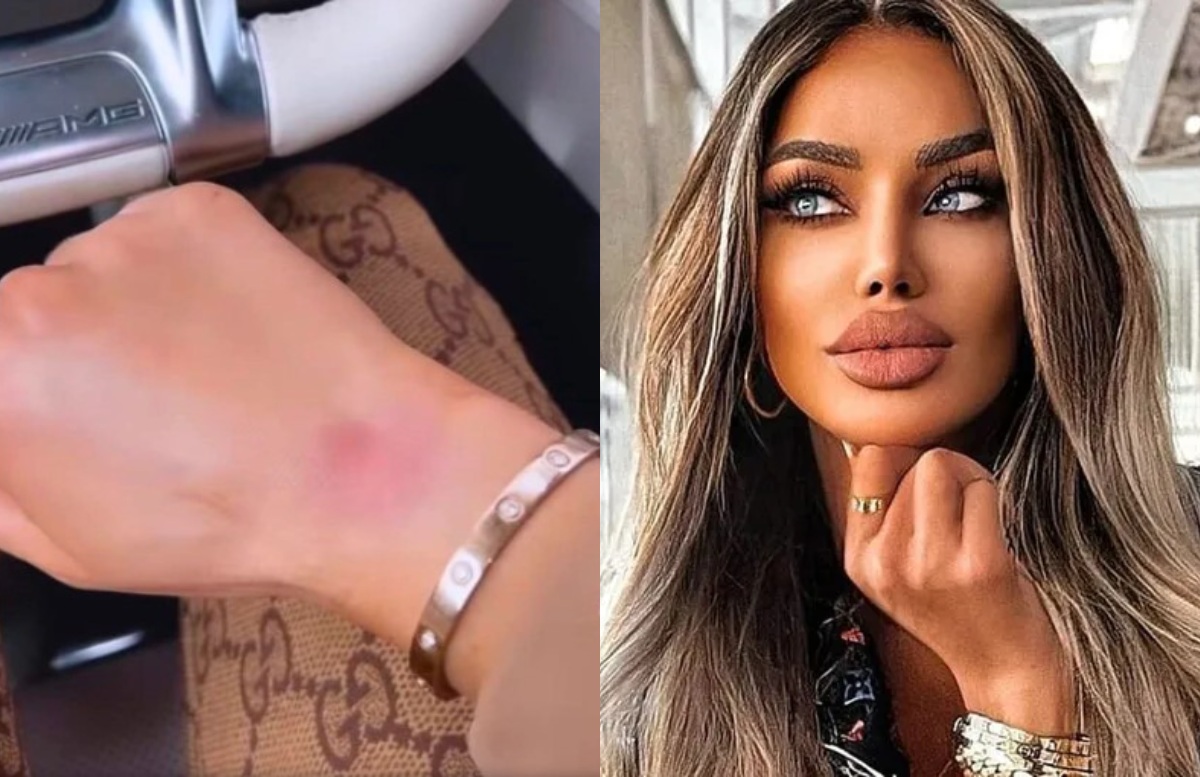 Imagine Stire Adevărul din spatele vânătăilor pe care le are Bianca Drăgușanu. Cu cine s-a bătut blondina, de fapt | 2review.ro